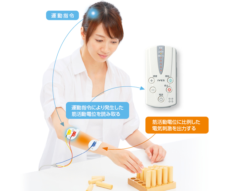 FES：機能的電気刺激（IVIS、ウォークエイド）｜石川病院