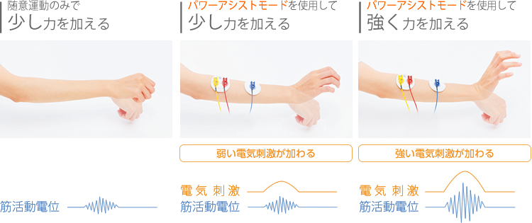 FES：機能的電気刺激（IVIS、ウォークエイド）｜石川病院