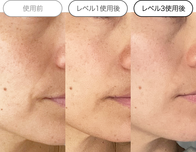 クエスクHQ1セラム | スキンケア化粧品・サイエンスコスメのビーグレン