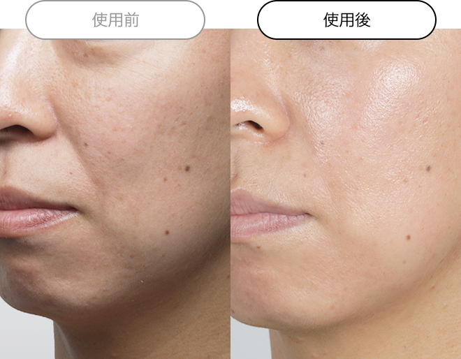 クエスクVC1セラム | スキンケア化粧品・サイエンスコスメのビーグレン