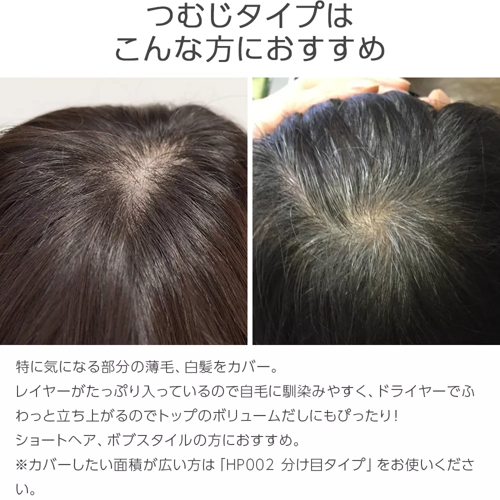 最高級人毛(レミー)100%トップヘアピース つむじタイプ（ポイント/医療