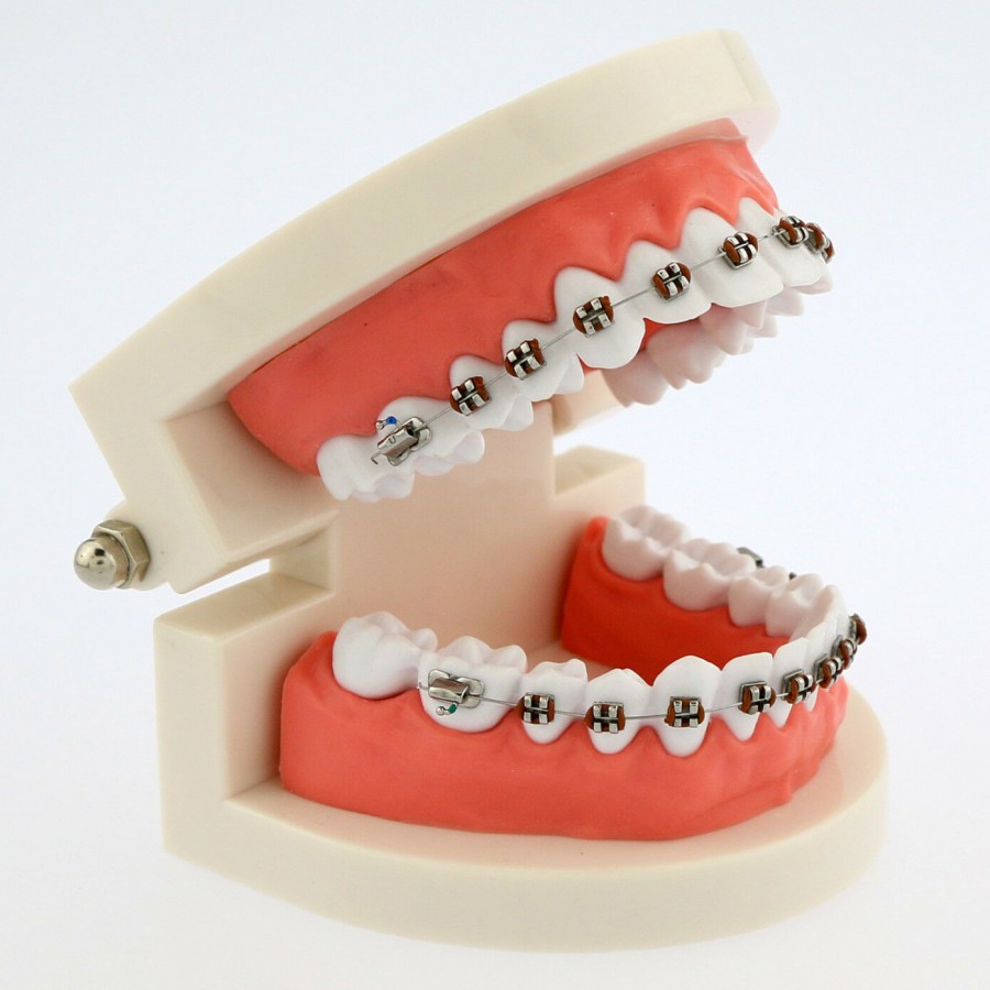 歯科モデル 歯列矯正 模型 研究教学用モデル ブレース付き 5006|歯科