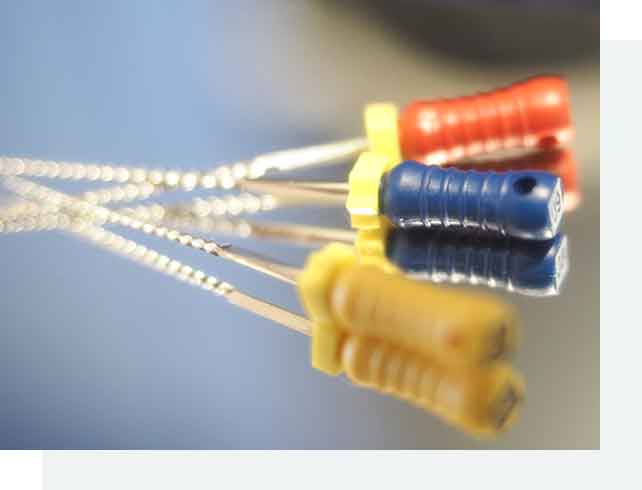 根管治療 | イースト21デンタルオフィス