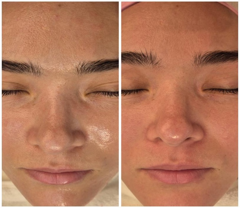 ララドクター（LHALA Doctor）｜美容皮膚科エルムクリニック