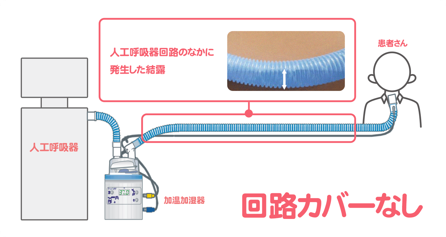 FIT フィット 人工呼吸器回路カバー 製品ウェブサイト