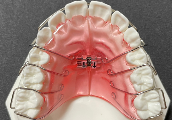 矯正治療について｜稲毛駅徒歩3分の矯正歯科｜つみき矯正歯科稲毛
