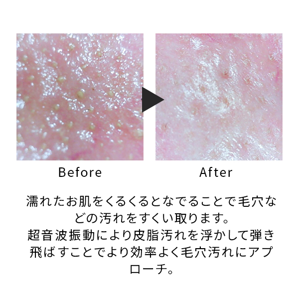 ミーゼ ディープスキンクリア｜ヤーマン公式通販サイト | ヤーマン