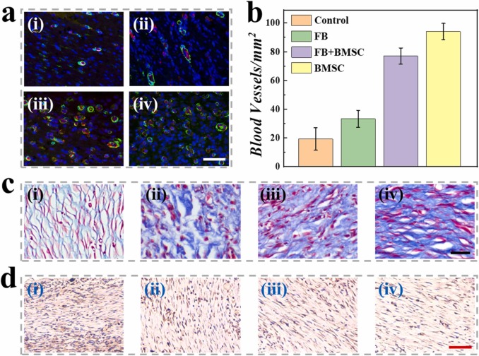 Harvesting stem cell exosomes from herringbone microfluidic