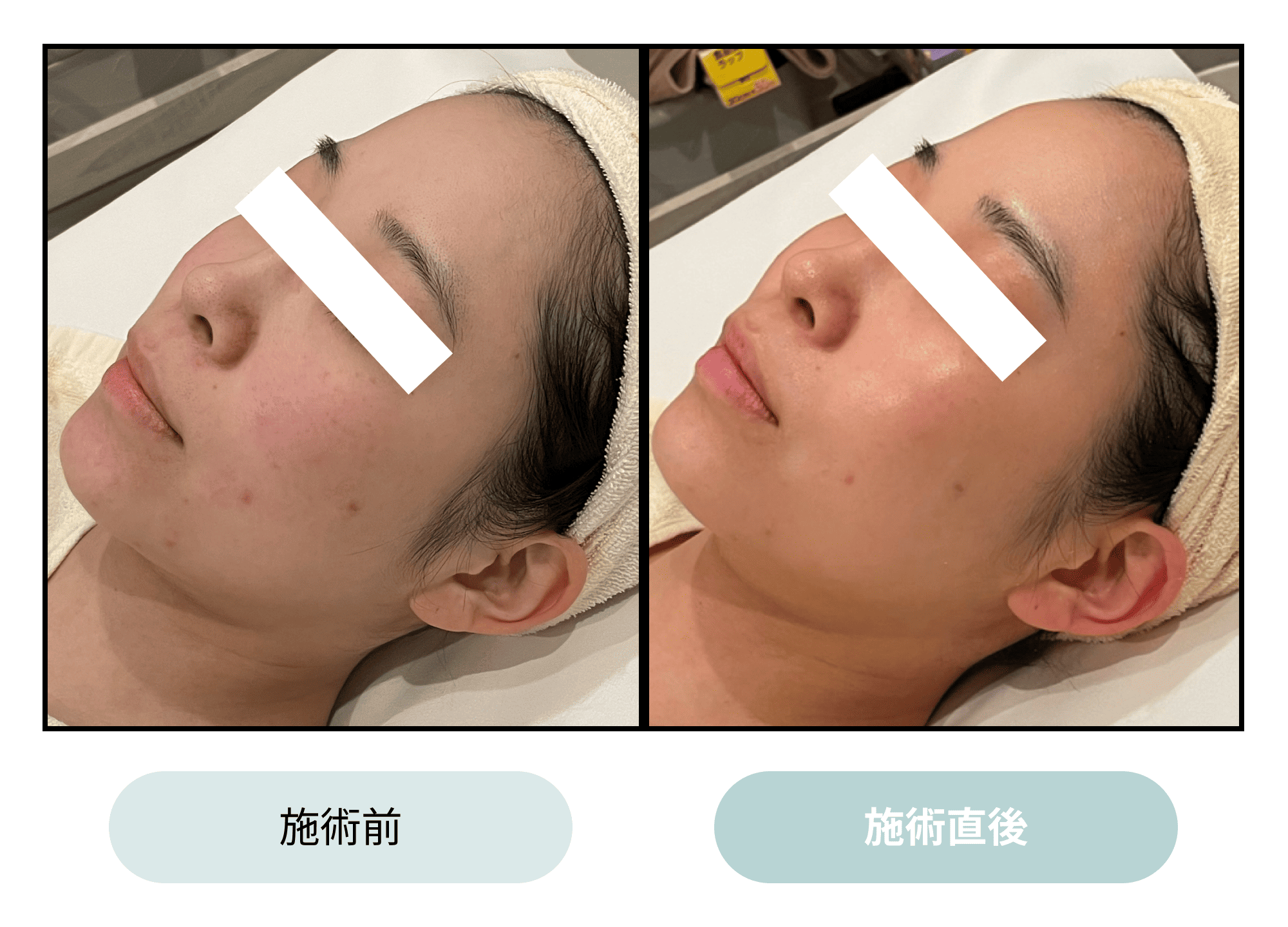 クリスティーナエステ｜ILLUSTRIOUS（イラストリアス）