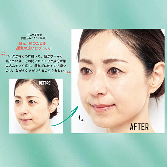 MEDI CHOUTHIQ]メディシュティーク フェイスコルセット炭酸パック