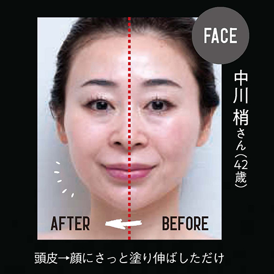 優待価格[Chino THE METHOD]ファシア アミノジスト ローション