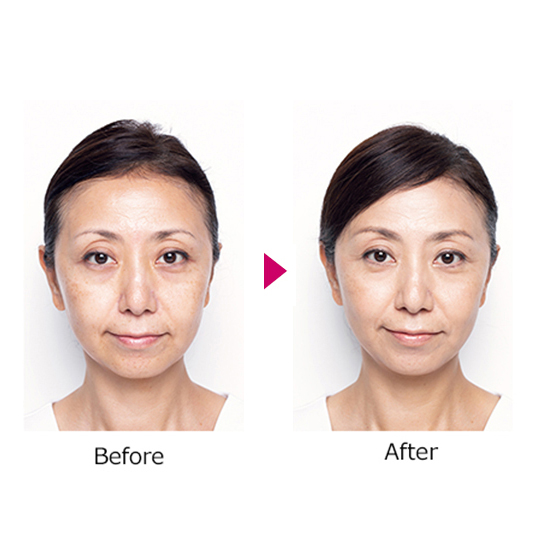 iGS4000]セレST限定セット超抗酸化サプリ&ジェル | KOBUNSHA SELECT