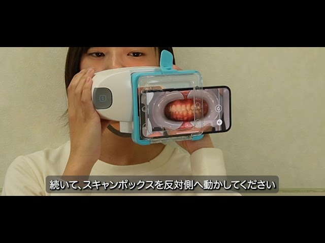 デンタルモニタリングについて｜旭川駅前あしたばデンタルクリニック