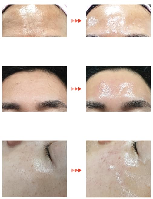 Amazon.com: [LHALALA Official] LHALA Peel Set (Basic + Ultra