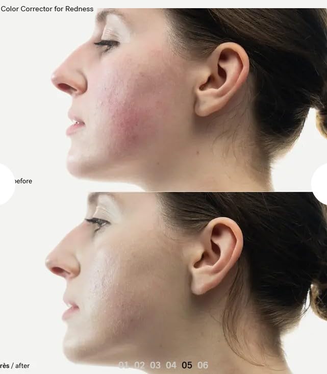 Amazon.com : Typology Color Corrector for Redness & Complimentary