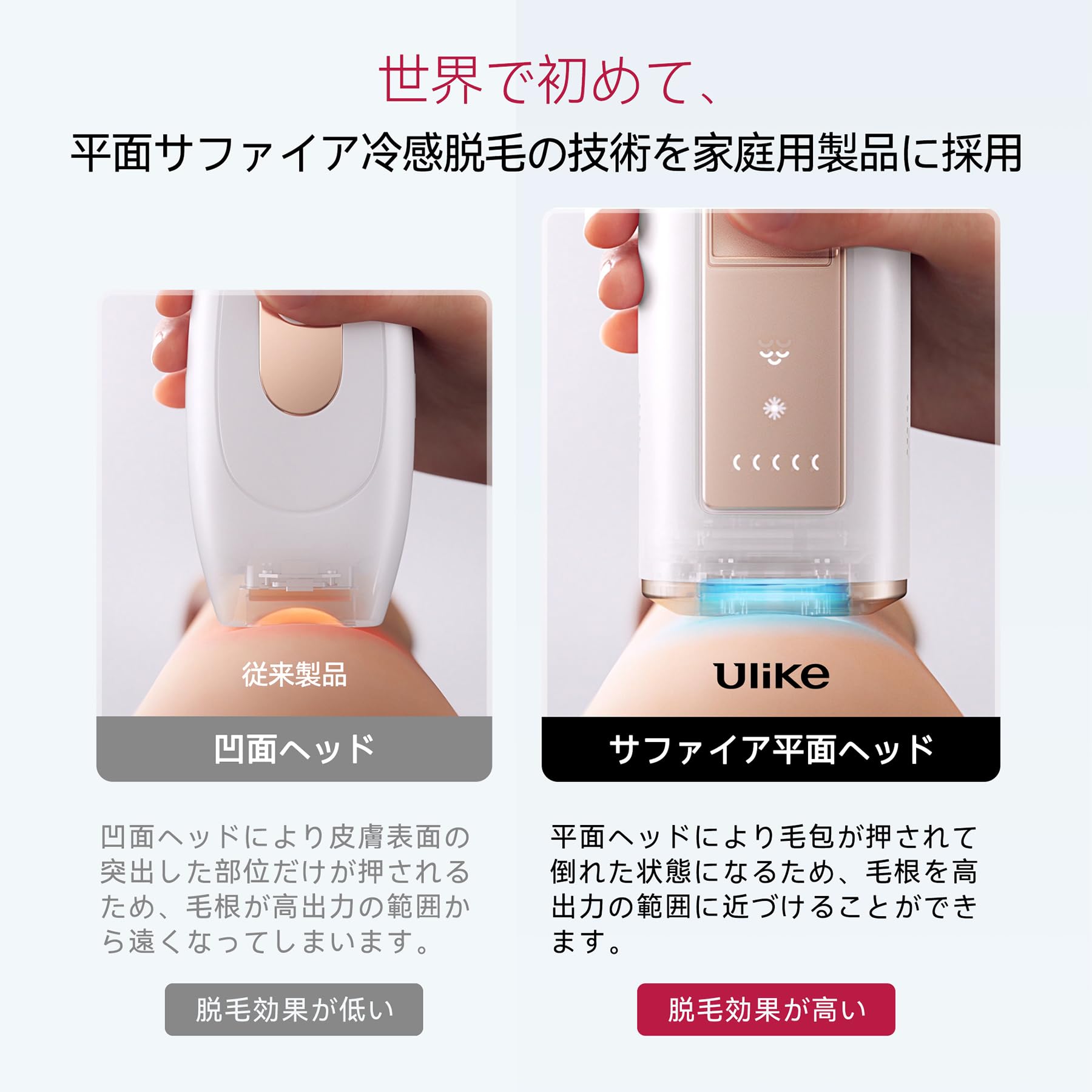 luna＊Ulike UI04M 脱毛器 IPL光脱毛器 楽天市場】Ulike ユーライク