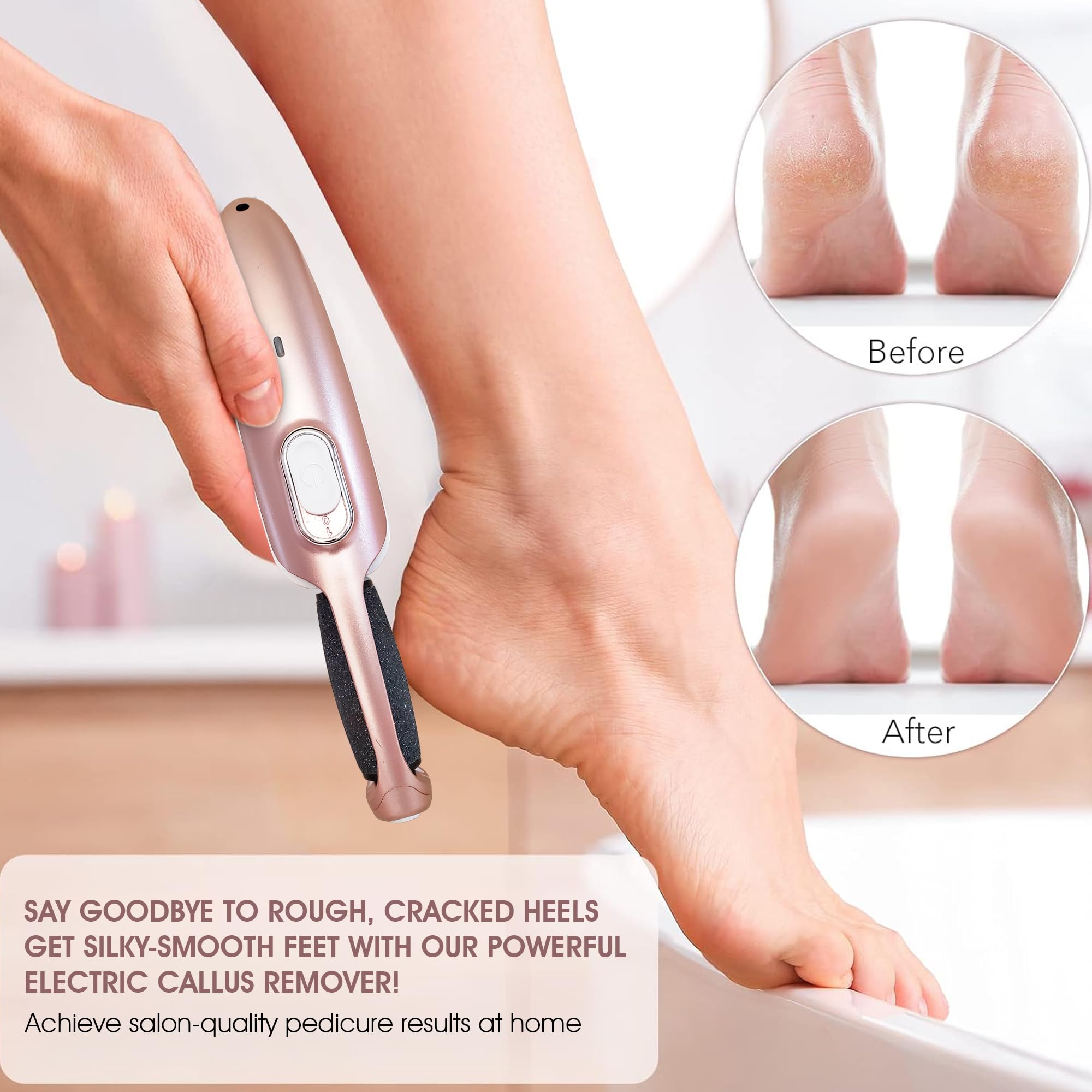 Amazon.com : Powerful Electric Callus Remover Wand – Rechargeable