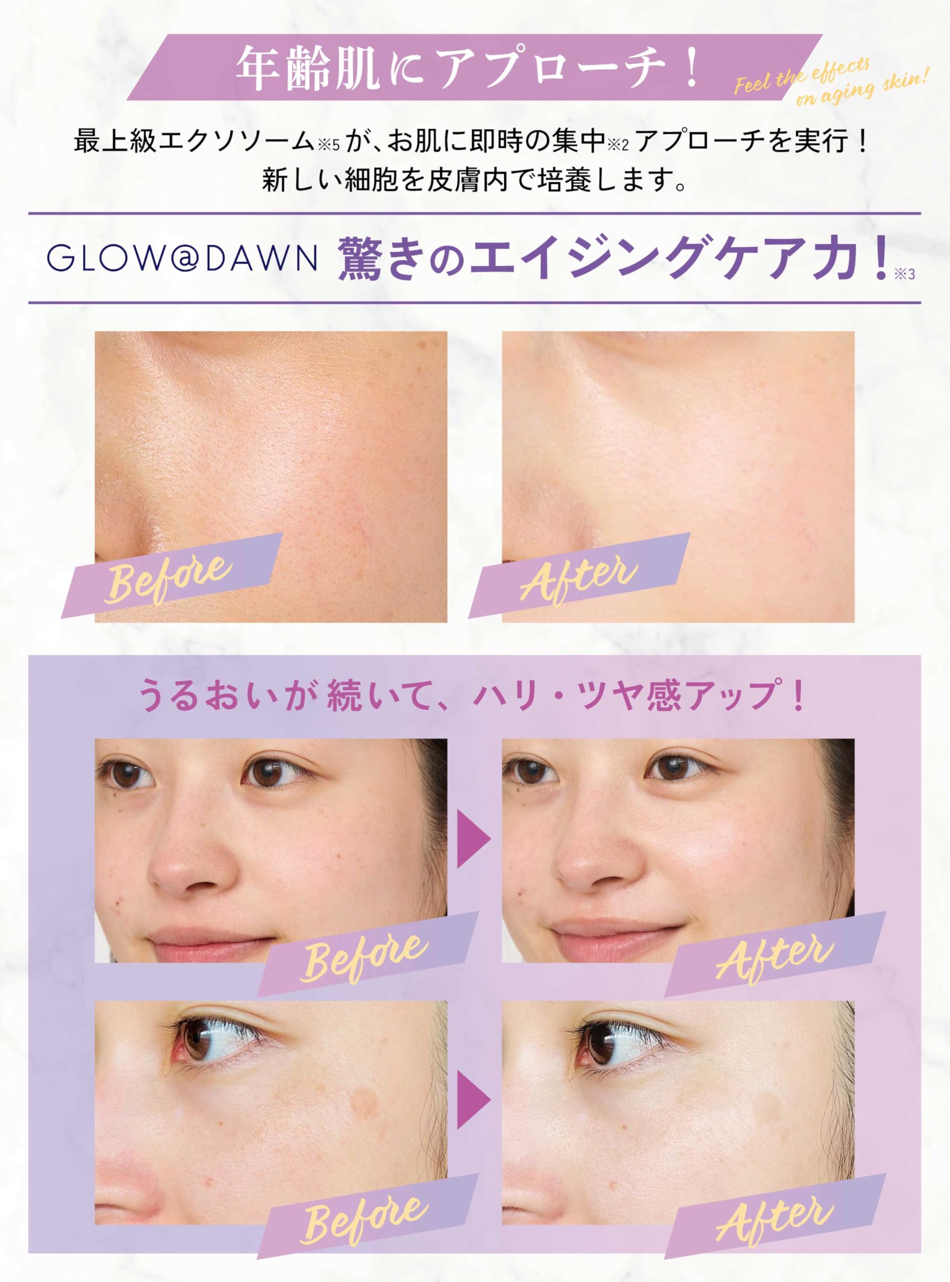 Amazon.co.jp: GLOW@DAWN 1st エクソソーム高濃度配合美容液 (日本製