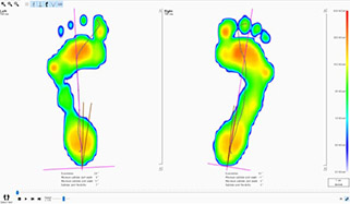 足底圧計測システム footscan®:足形計測ならJust My Shoes【株式会社
