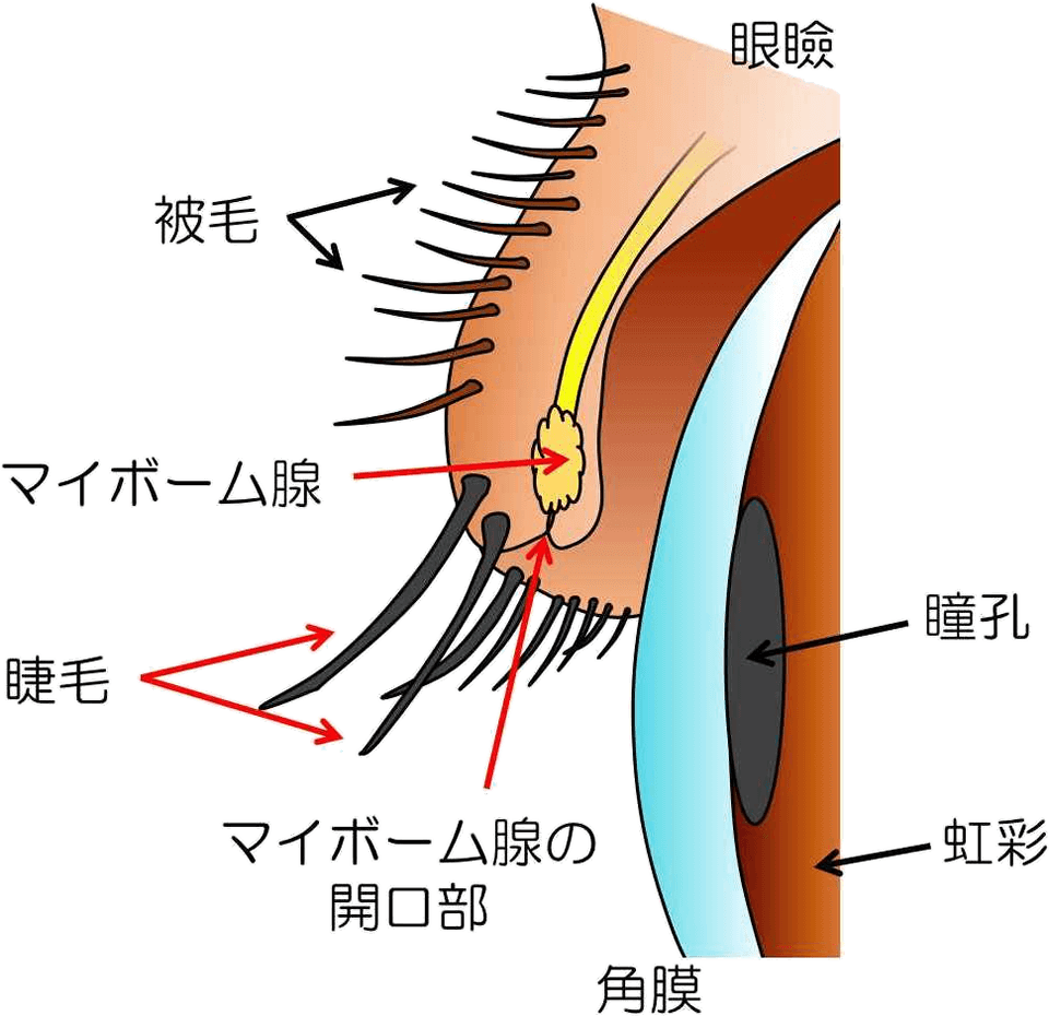 IPL治療 | 医療法人アネモネ 沖田眼科医院（佐賀市）