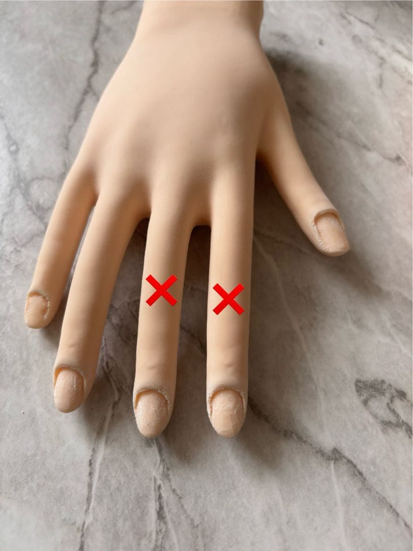 認定ハンド 両手 右手骨折2本有り