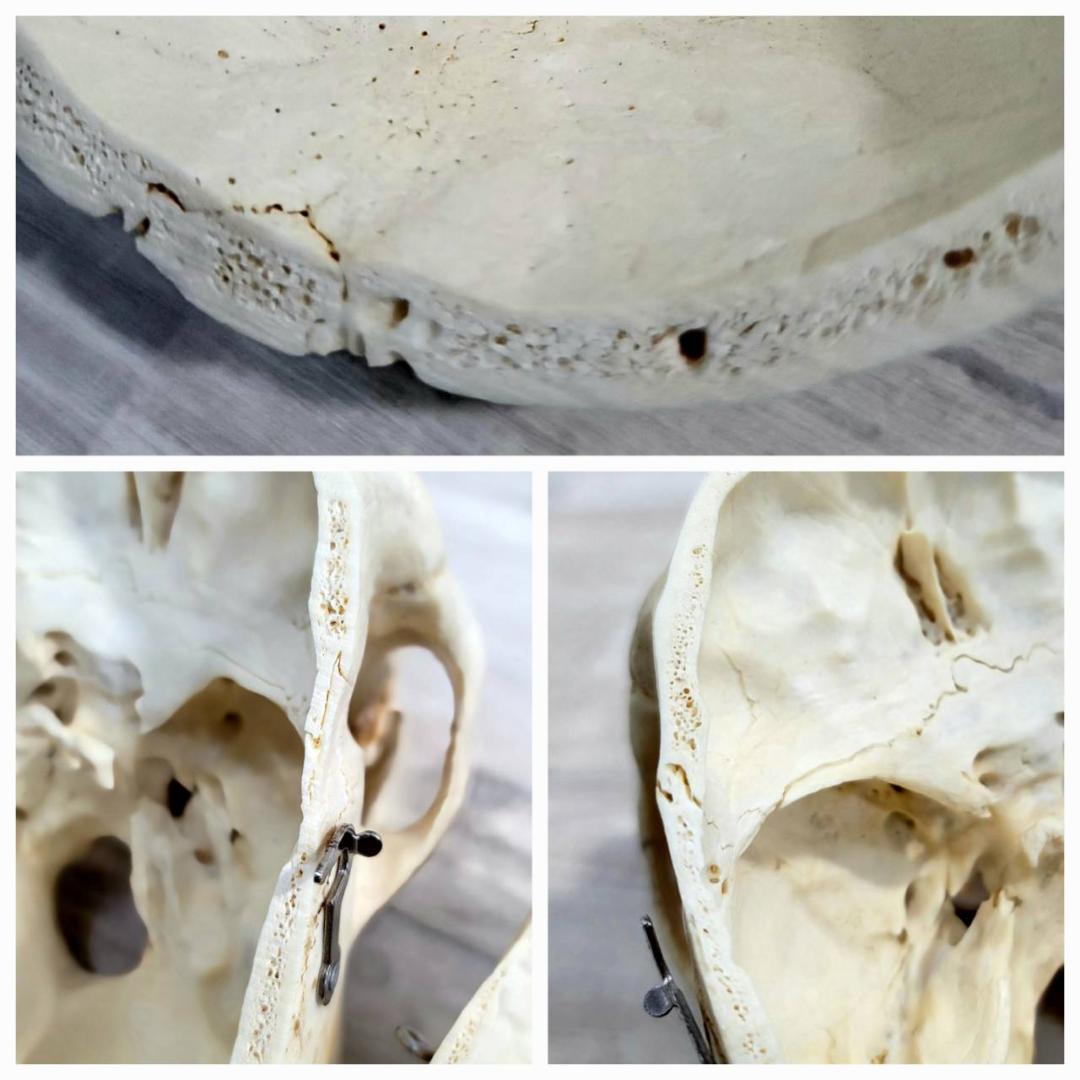 頭蓋骨 頭骨 骨格標本 人体模型 医療 医学 人類学 民俗学 アンティーク